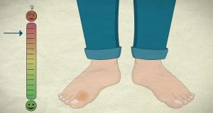 Ayak parmağının kırıldığı nasıl anlaşılır?